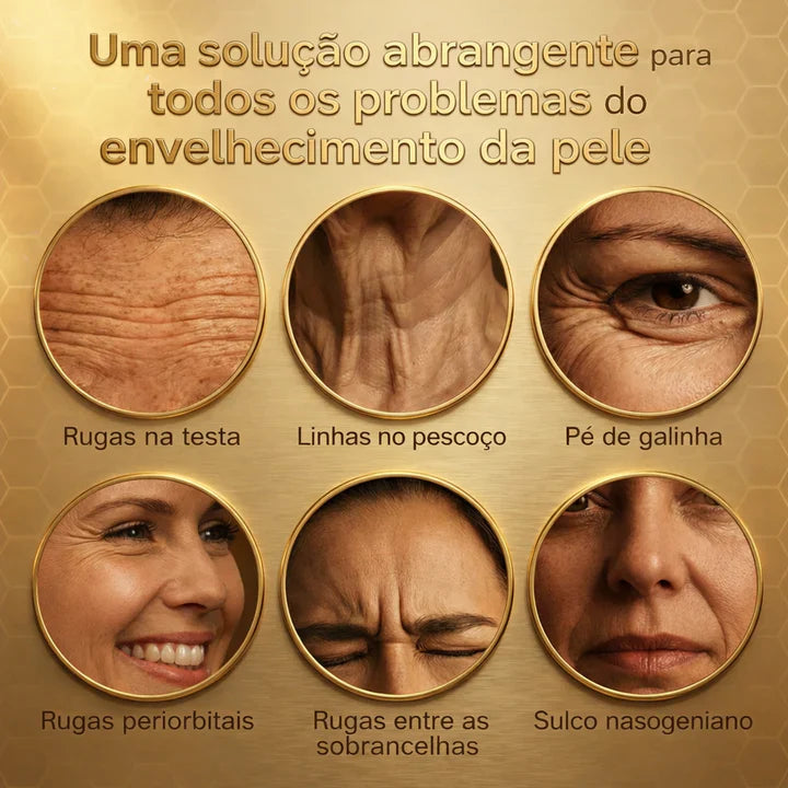 Kit Bee Venom Completo: 2 Corporais + 1 Botox Facial — Só Hoje