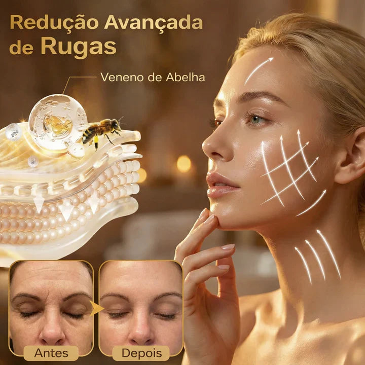 Kit Bee Venom Completo: 2 Corporais + 1 Botox Facial — Só Hoje
