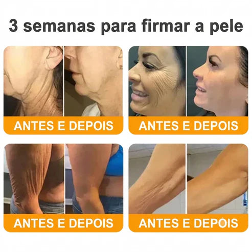 Creme 𝐁𝐞𝐞 𝐕𝐞𝐧𝐨𝐦 -  Compre 1 e Leve 2 — Só Hoje