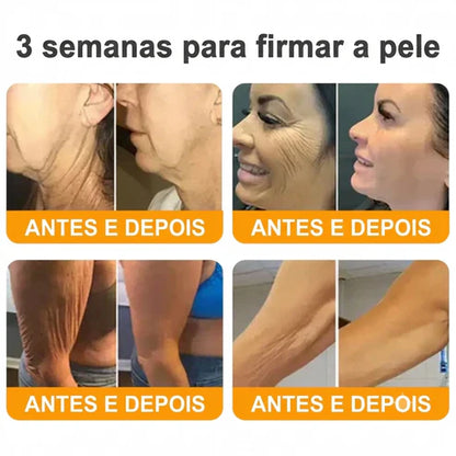 Creme 𝐁𝐞𝐞 𝐕𝐞𝐧𝐨𝐦 -  Compre 1 e Leve 2 — Só Hoje
