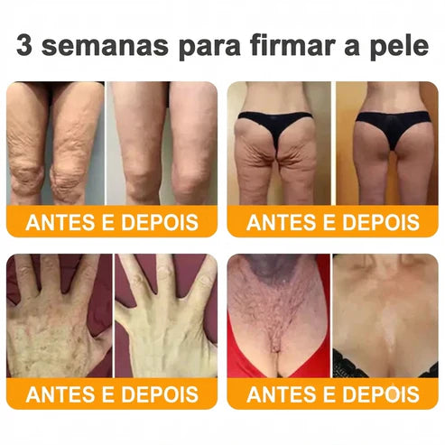 Creme 𝐁𝐞𝐞 𝐕𝐞𝐧𝐨𝐦 -  Compre 1 e Leve 2 — Só Hoje